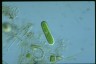 Cylindrocystis