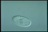 Paramecium trichium