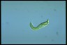 Euglena oxyuris