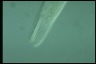 Spirostomum intermedium