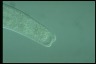 Spirostomum intermedium