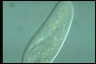 Paramecium