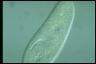 Paramecium