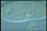 Paramecium caudatum