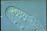 Paramecium caudatum