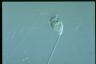 Vorticella microstoma