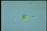 Asterococcus