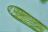 Surirella