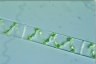 Spirogyra