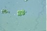 Apatococcus lobatus