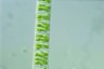 Spirogyra