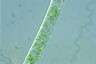 Spirogyra