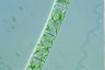 Spirogyra