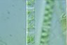 Spirogyra