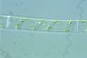 Spirogyra