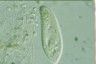 Paramecium caudatum