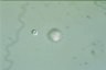 Choanocystis