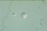 Choanocystis