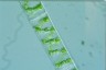 Spirogyra