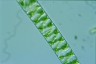 Spirogyra