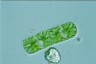 Cylindrocystis