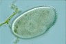 Ophryoglena marina