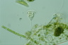 Vorticella