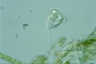 Vorticella