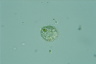 Choanocystis aculeata