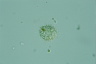 Choanocystis aculeata