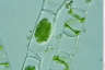 Spirogyra