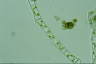 Spirogyra