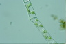 Spirogyra