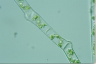 Spirogyra