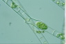 Spirogyra