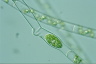 Spirogyra