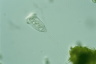 Vorticella