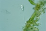 Vorticella