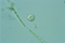 Pterocystis