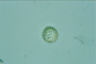 Choanocystis