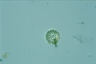 Choanocystis