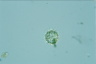 Choanocystis