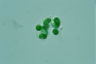 Glaucocystis nostochinearum