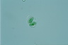 Glaucocystis nostochinearum