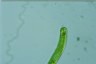 Euglena oxyuris