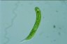 Euglena oxyuris