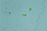 Euglena