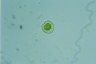 Dysmorphococcus punctatus