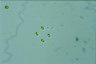 Oocystis