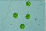 Asterococcus